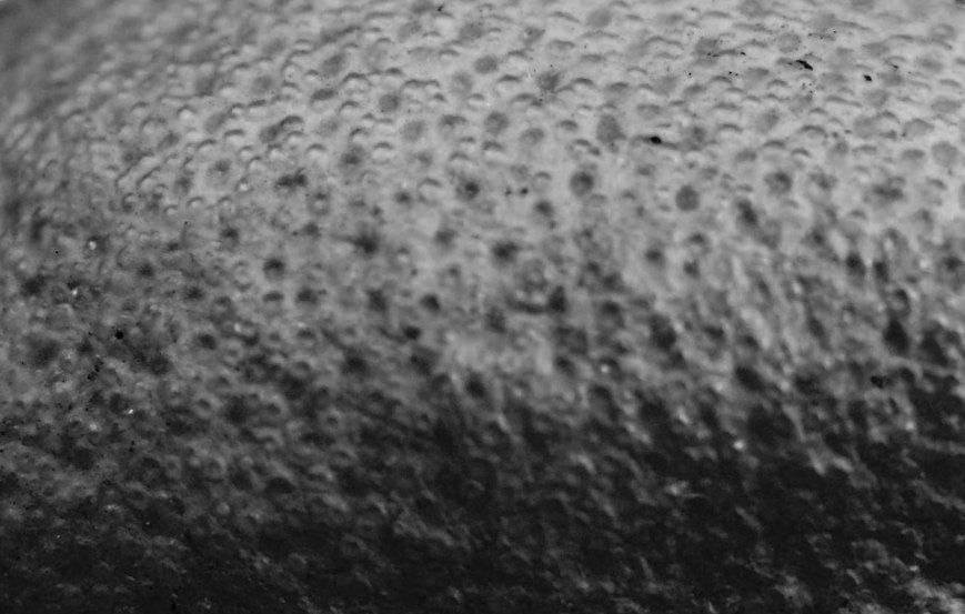 Your Scalp Is Skin, Now What?