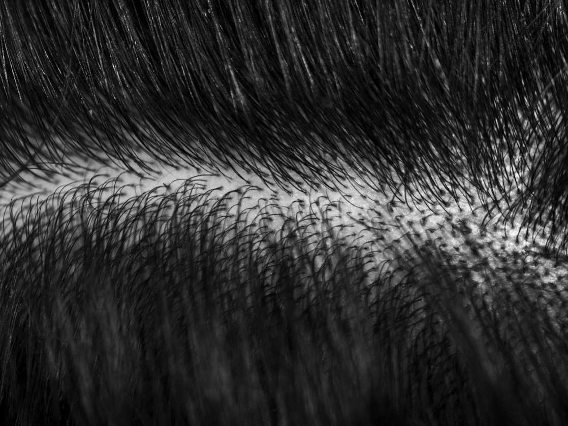 Scalp vs. Hair: What’s the Difference?